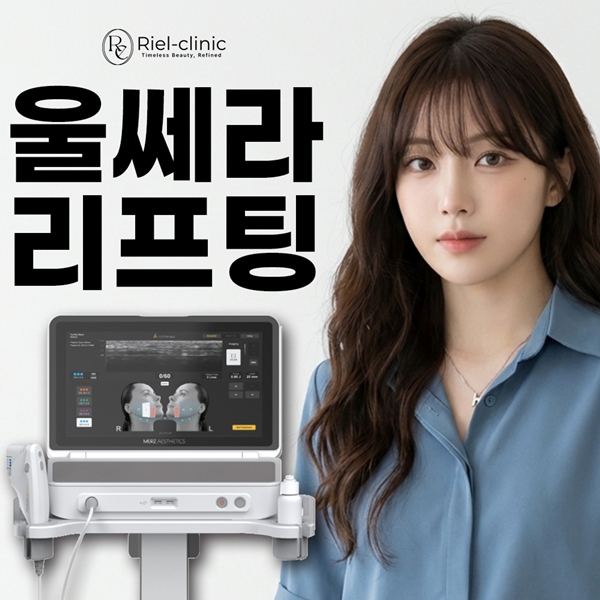 울쎄라 리프팅 시술